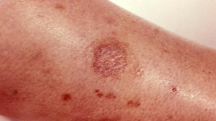 GOST Chemische gevarenklasse