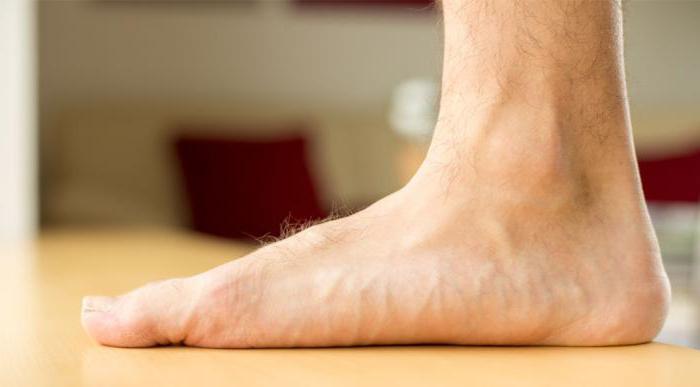 hoe te plegen van het leger met platte voeten