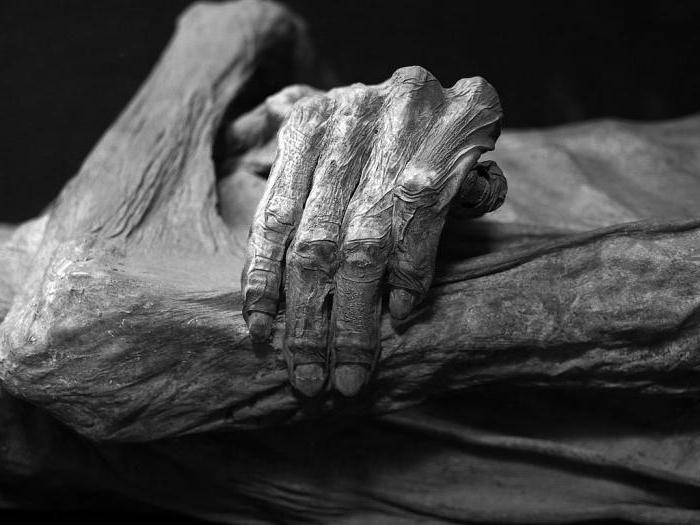 wczesne i późne oznaki śmierci biologicznej