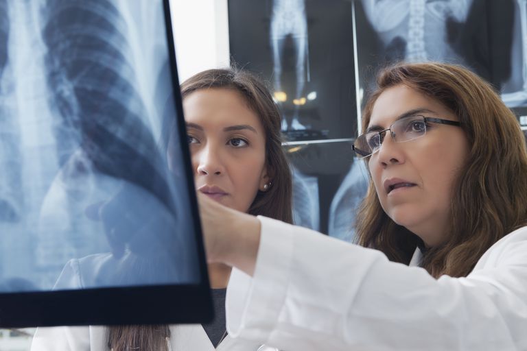 Jak często wykonuje się fluorografię?